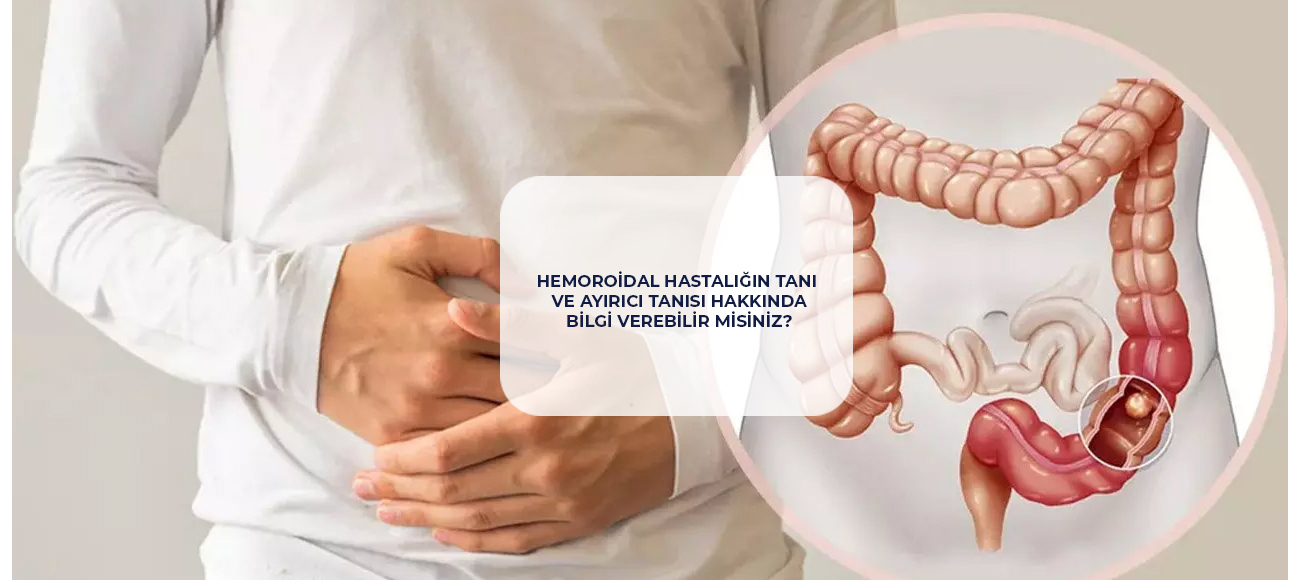 Hemoroidal Hastalığın Tanı ve Ayırıcı Tanısı Hakkında Bilgi Verebilir Misiniz?