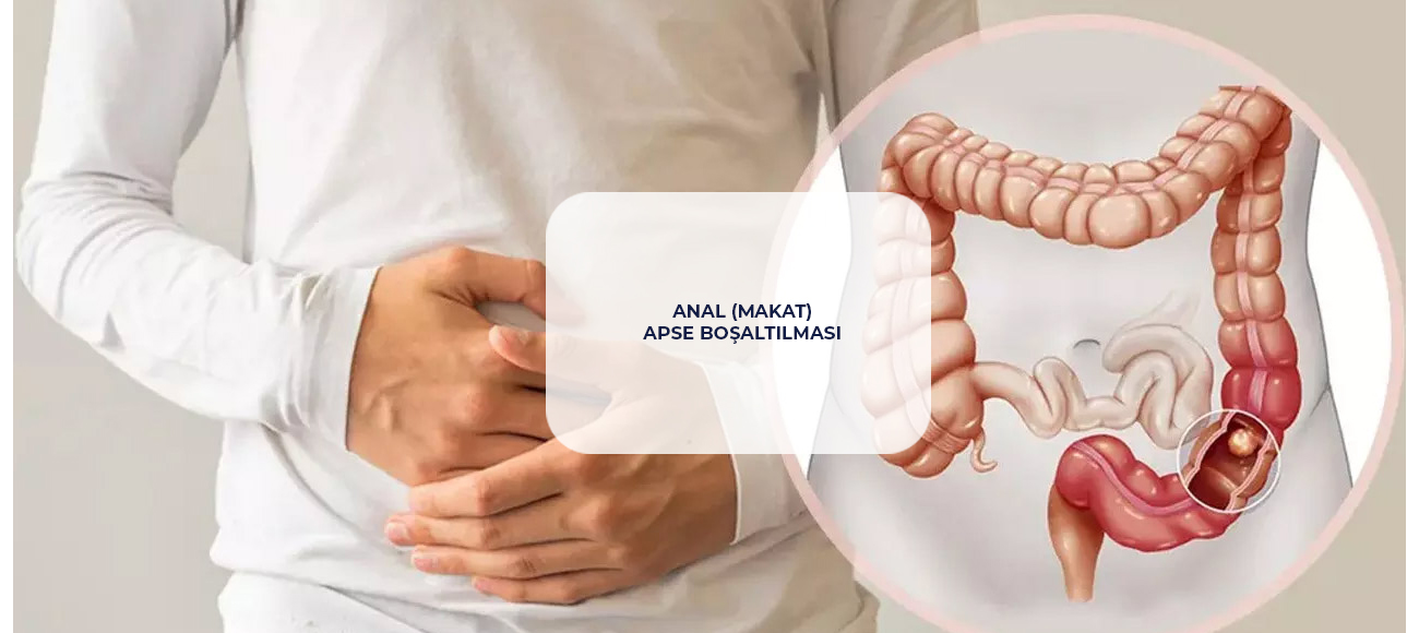 Anal (Makat) Apse Boşaltılması